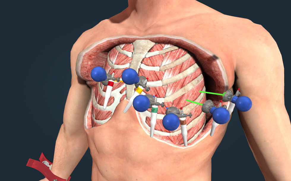 The electrocardiogram (ECG) - 3D сценa - BG Електронно обучение и учене ...