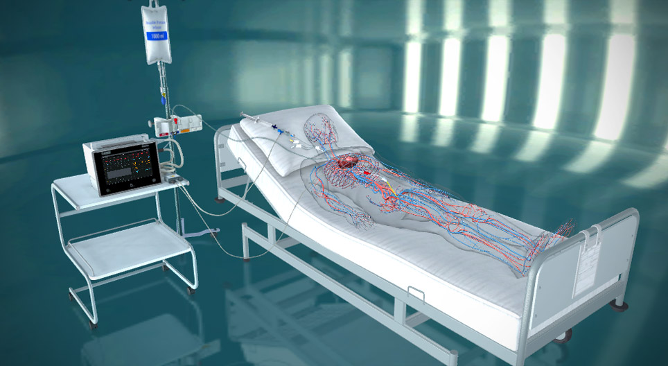 Invasive hemodynamic monitoring