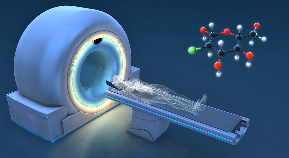 Какво представлява PET-CT?