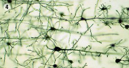 Нервна тъкан