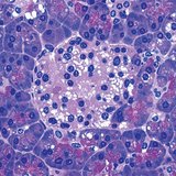 Група от клетки в панкреаса, които произвеждат инсулин