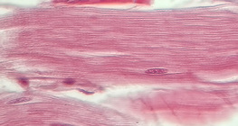 Тъкан на сухожилие (надлъжен разрез)