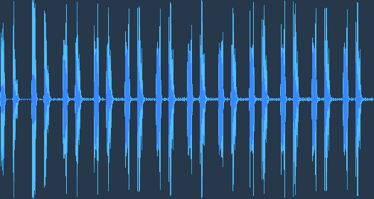 Нормален сърдечен тон