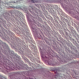 Тъкан на сухожилие (напречен разрез)