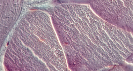 Тъкан на сухожилие (напречен разрез)