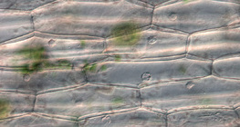 Растителни епидермални клетки