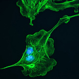 Цитоскелет (клетки от бял дроб на говедо)