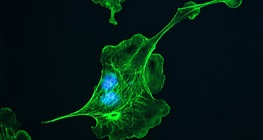 Цитоскелет (клетки от бял дроб на говедо)