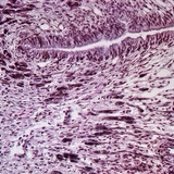 Напречен разрез на крака на охлюв