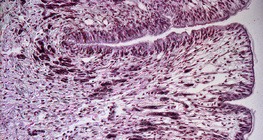 Напречен разрез на крака на охлюв