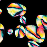 Starch granules in potato