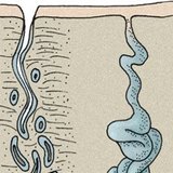 Кожни жлези: потни