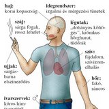 A dohányzás lehetséges következményei 