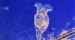 Ротифери (на цветен фон)