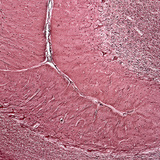 Разрез на човешки малък мозък