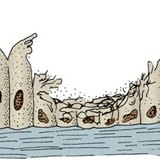 Ресничест епител от дихателните пътища на пушач