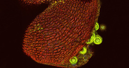 Разтварящи се поленови торбички на мирабилис (конфокален лазерен микроскоп)