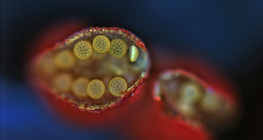 Разтварящи се поленови торбички на мирабилис (оптичен микроскоп)