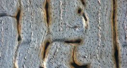 Кост (надлъжен шлифован разрез)