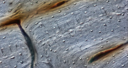 Кост (надлъжен шлифован разрез)