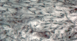 Рехава влакнеста съединителна тъкан