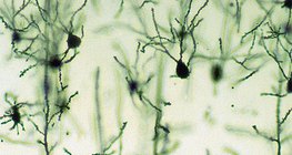 Невроните на мозъчната кора