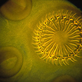 Сколекс на тения с венец от кукички и смукала