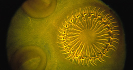 Сколекс на тения с венец от кукички и смукала