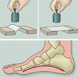 Изследваме свода на крака