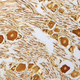 Нервни клетки в гръбначномозъчен ганглий