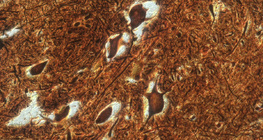 Нервни клетки в гръбначен мозък (говедо)