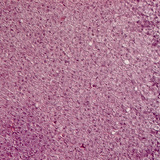 Напречен разрез на надбъбречна жлеза