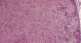 Напречен разрез на надбъбречна жлеза