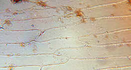 Клетки от вътрешните месести слоеве на лук