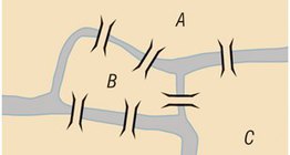 Седемте моста на Кьонигсберг