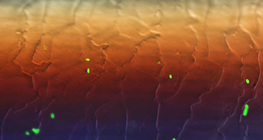 Флуоресцентни бактерии (E.coli), разположени на един косъм