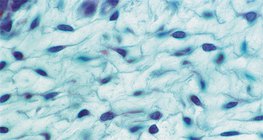 Рехава влакнеста съединителна тъкан