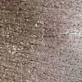 Човешка мозъчна кора, виждат се различните клетъчни пластове