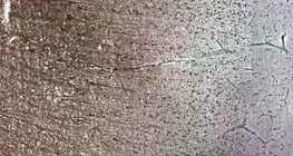 Човешка мозъчна кора, виждат се различните клетъчни пластове