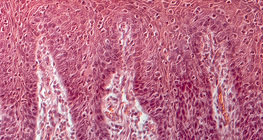 Напречен разрез на език (човек)