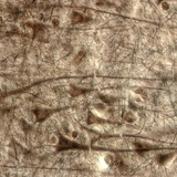 Човешка мозъчна кора, вижда се слоят с големите пирамидни клетки