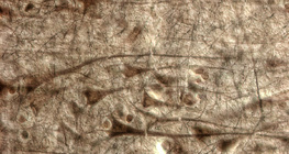 Човешка мозъчна кора, вижда се слоят с големите пирамидни клетки