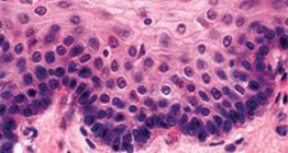 Многопластов, незадебелен епител