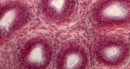 Напречен разрез на семенни канали