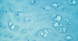 Хрущялната тъкан