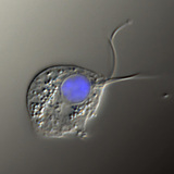 Трихомонас вагиналис (контрастово изображение с диференциална интерференция, ядрото на клетката е оцветено в синьо)