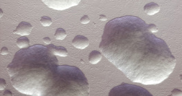 Колонии на бактерията E.coli (неоцветени, бели)