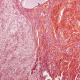 Хипофиза  (надлъжен разрез, малко увеличено изображение)