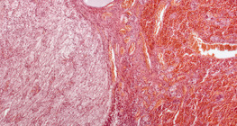 Хипофиза  (надлъжен разрез, малко увеличено изображение)