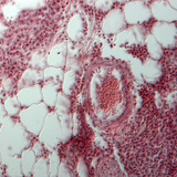 Разрез на бял дроб (човек)